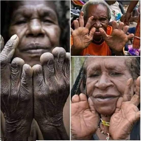 The Dani Tribe: A Heartbreaking Tradition of Mourning