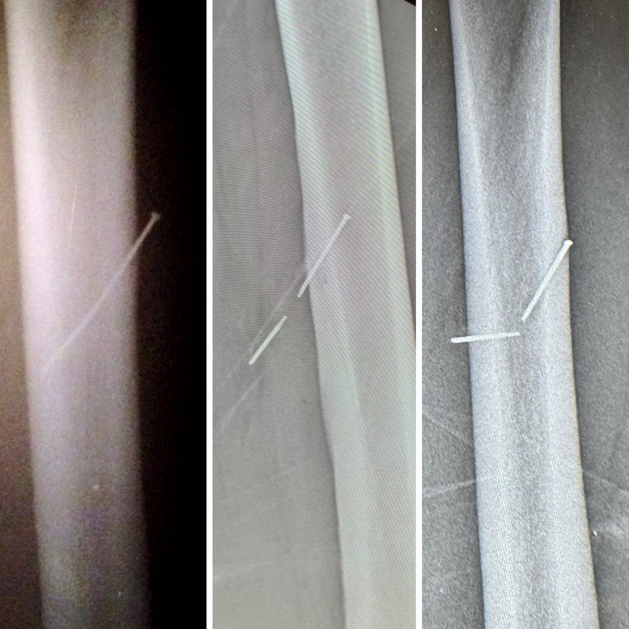 Injured by a Nail Gun in 2007: The Aftermath Revealed