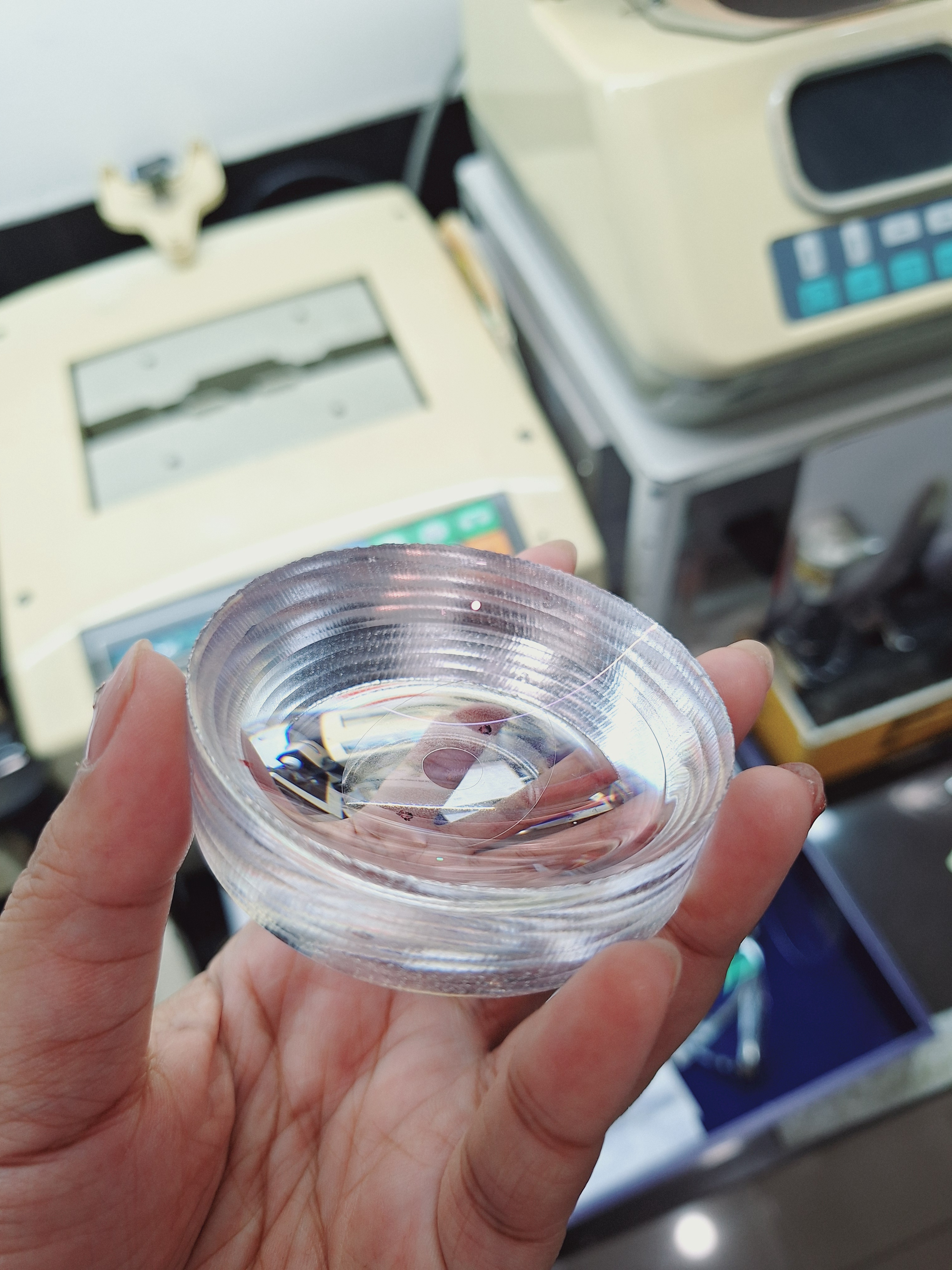 A Glimpse into My 27-Year-Old Female Patient's Lenses