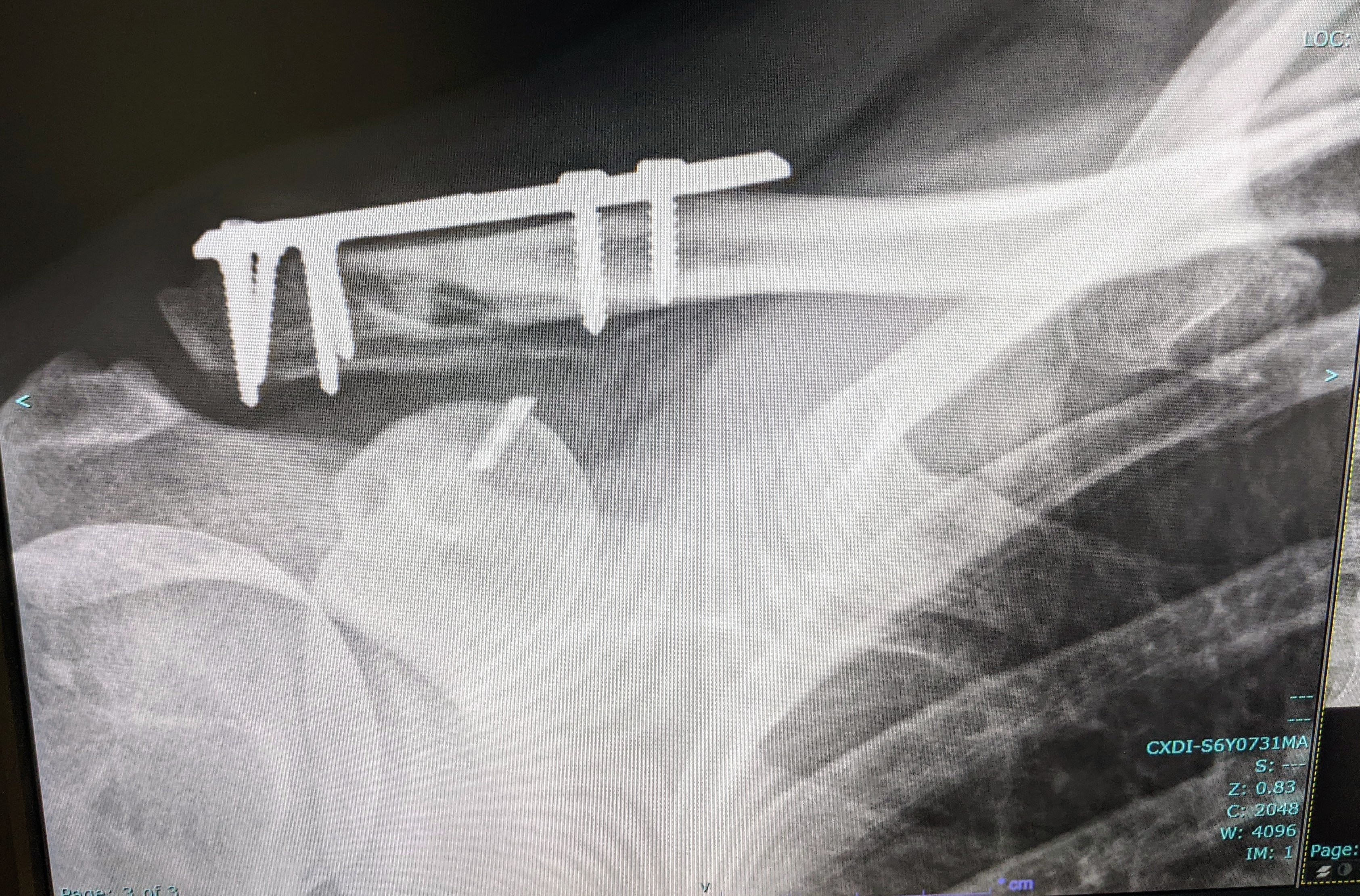 These Healed Up Pain-Free: A Success Story