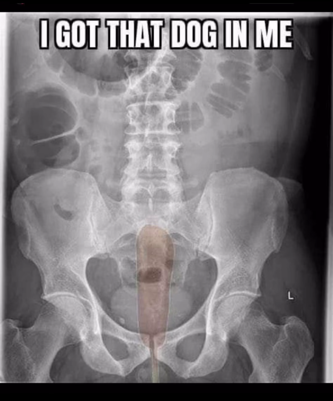 Memes recycled for your enjoyment: #44