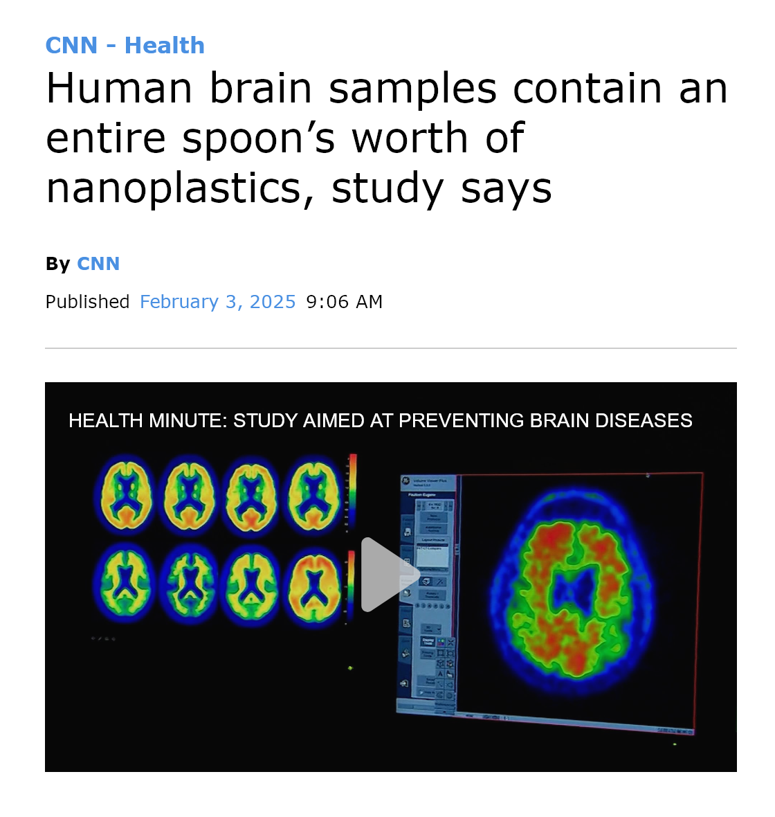 Surge in Plastic Found in Brain Samples Since 2016