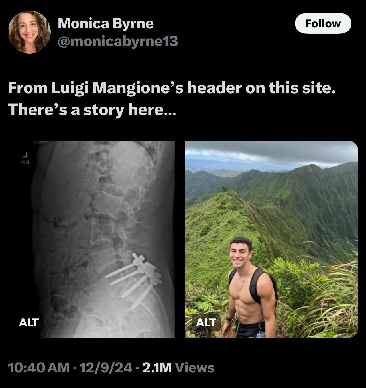 The Origin Story of Luigi Mangione: Unveiling the Legend