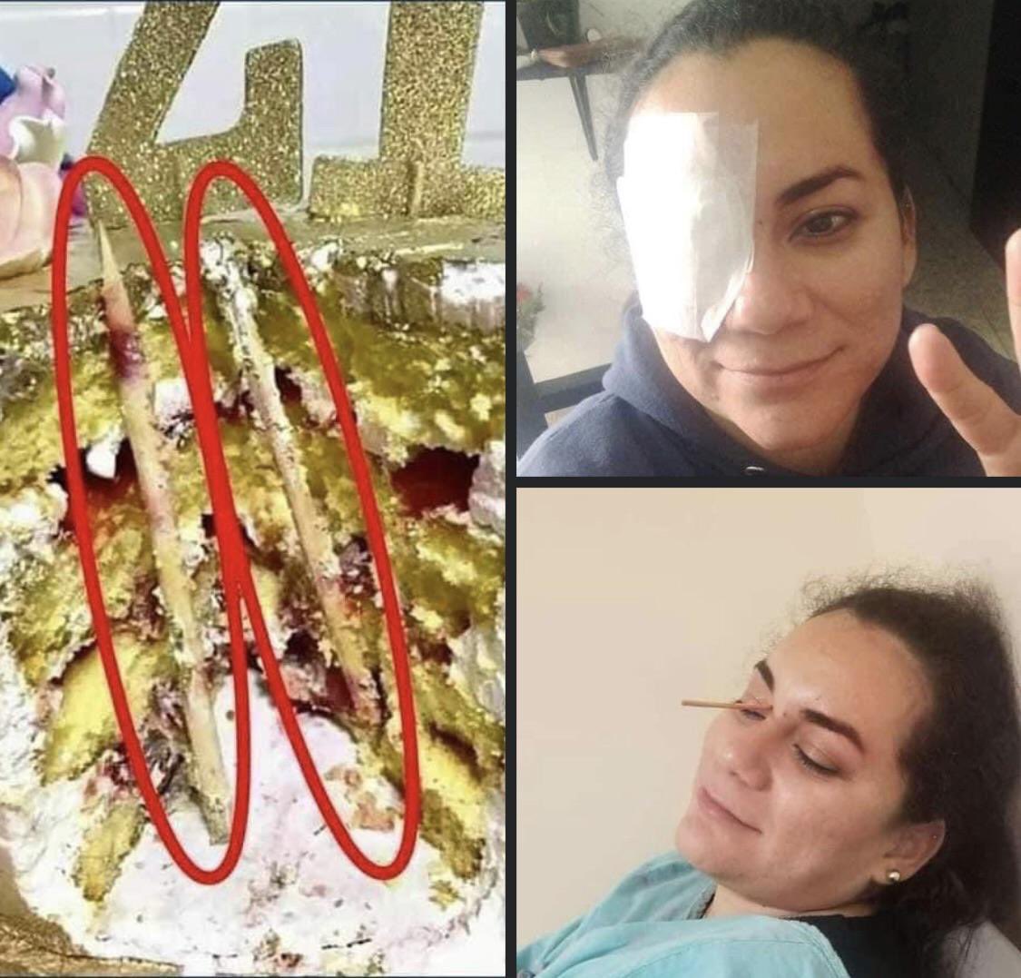 Think Twice Before Shoving Someone's Head in a Cake: Apologies for the Image