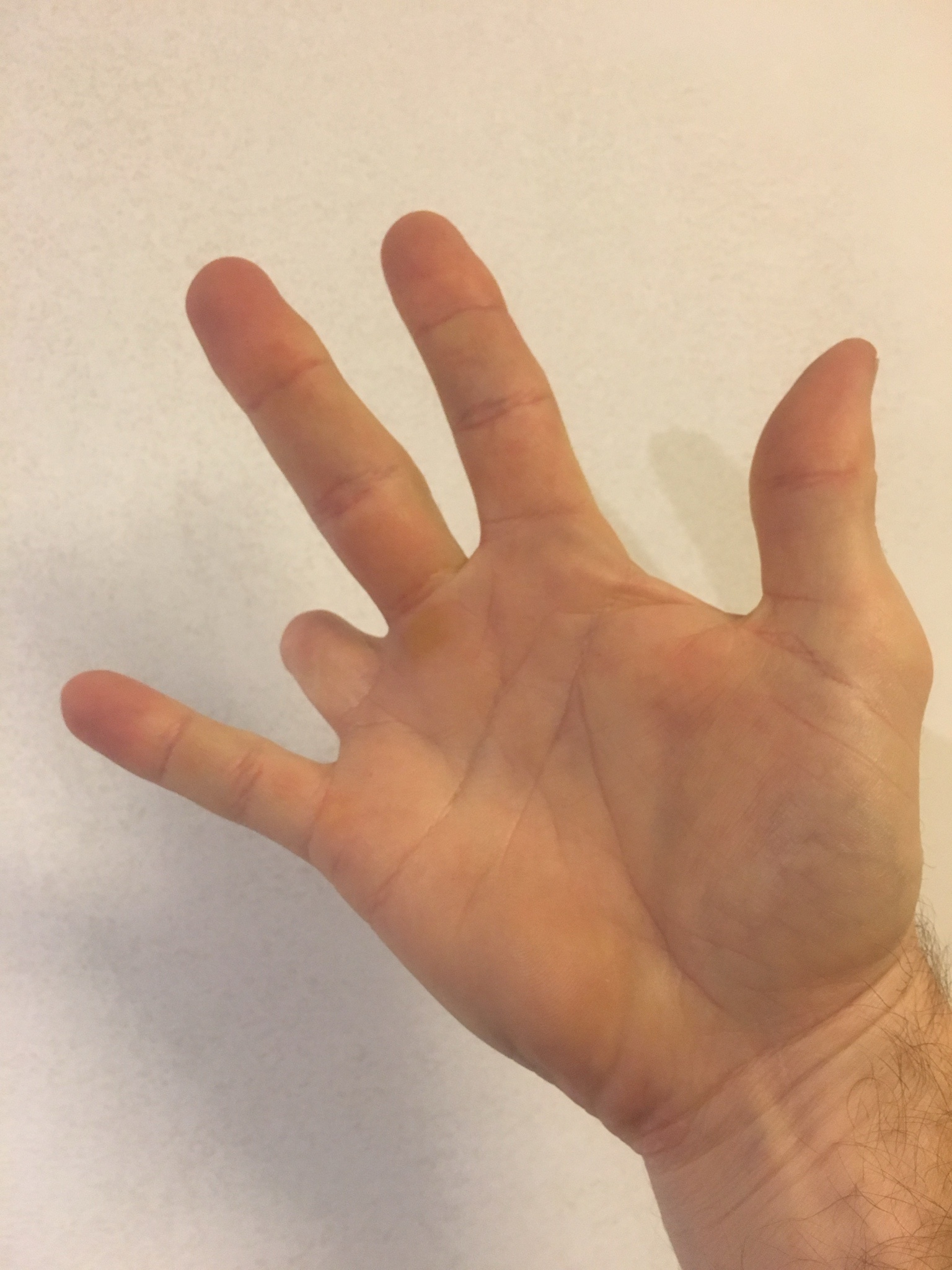 The Mysterious Hand: What Does It Mean?