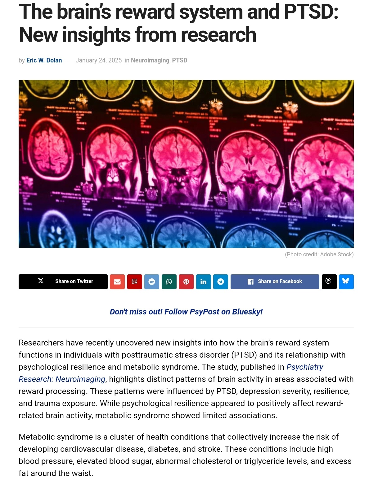 Exploring the Brain's Reward System and PTSD: Fresh Research Insights