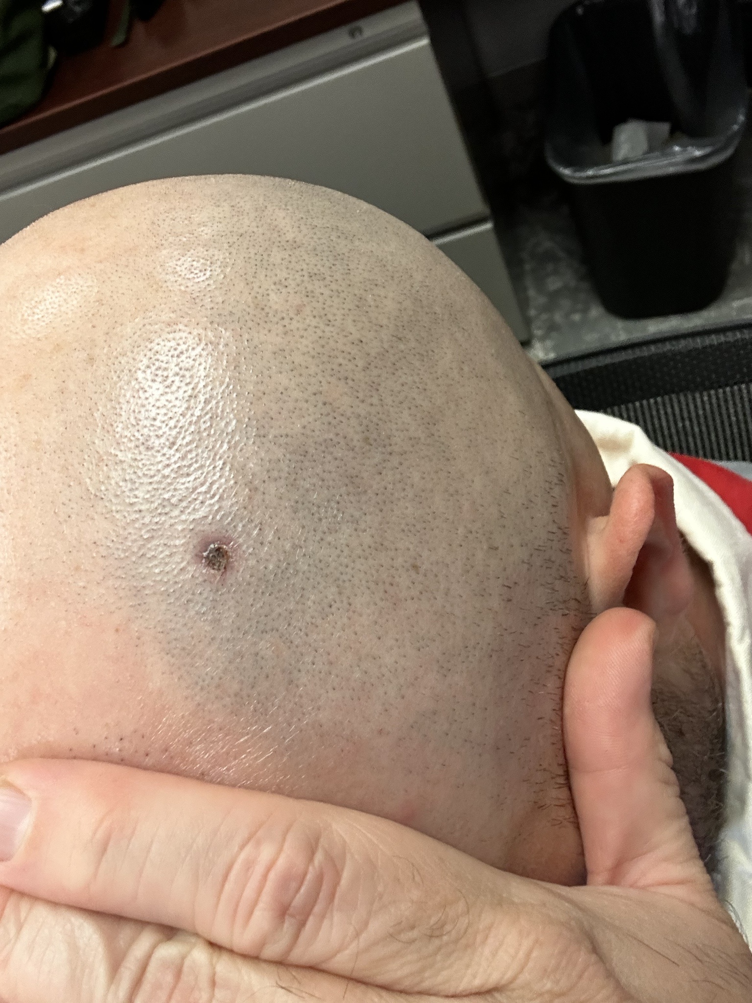 If that stubborn scab won't heal, it's time to see a doctor.