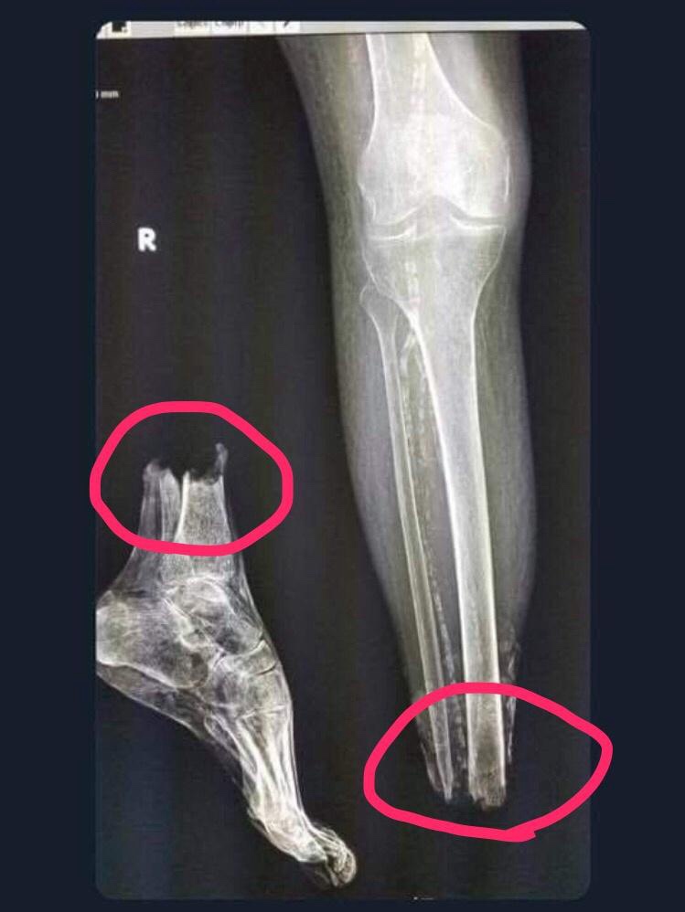 Whoops! A Little Mishap