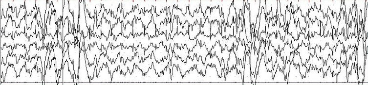 Exploring SCP-1237: The Epsilon Wave