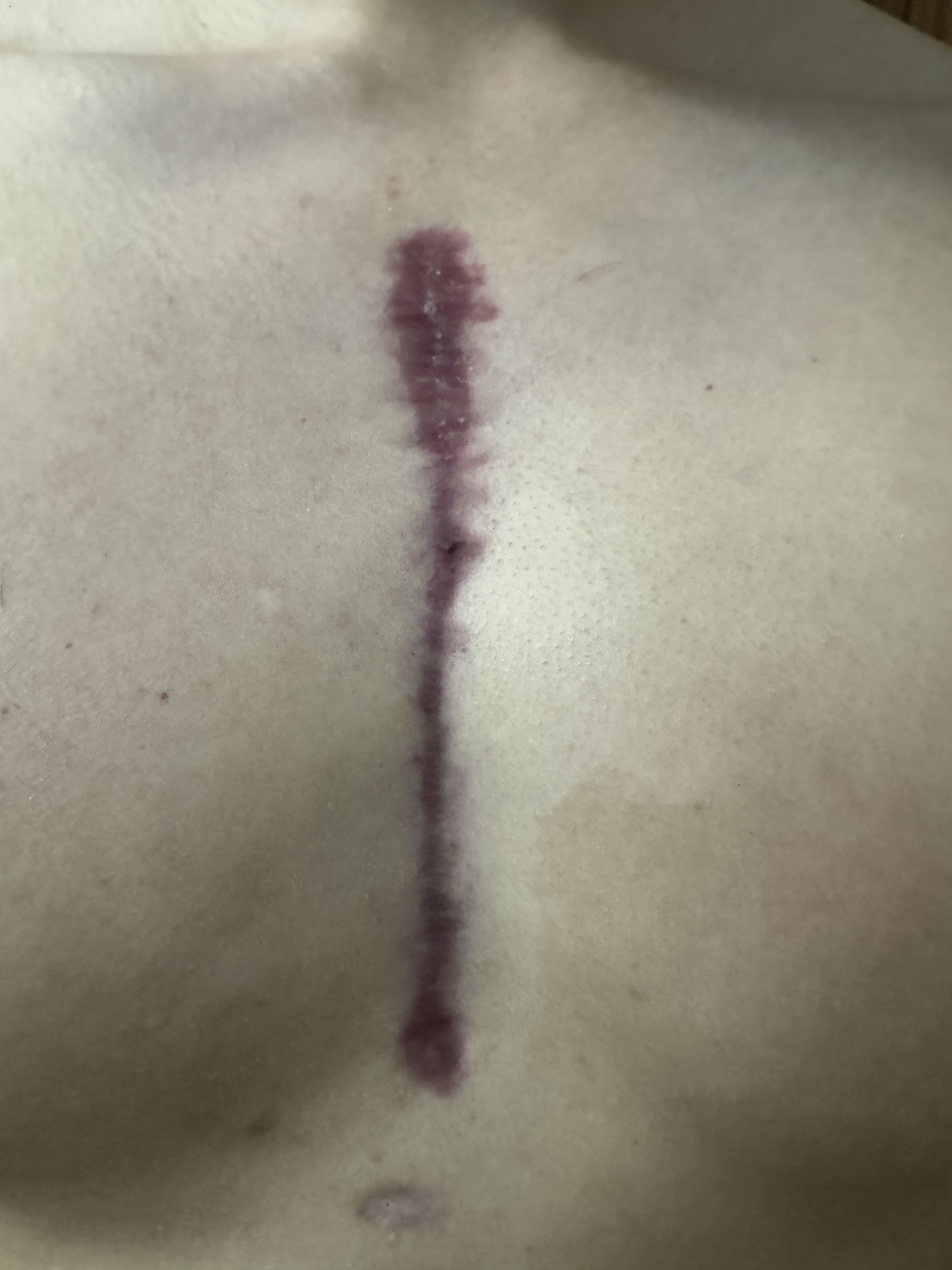 Heartache: The Wound That Just Won't Heal