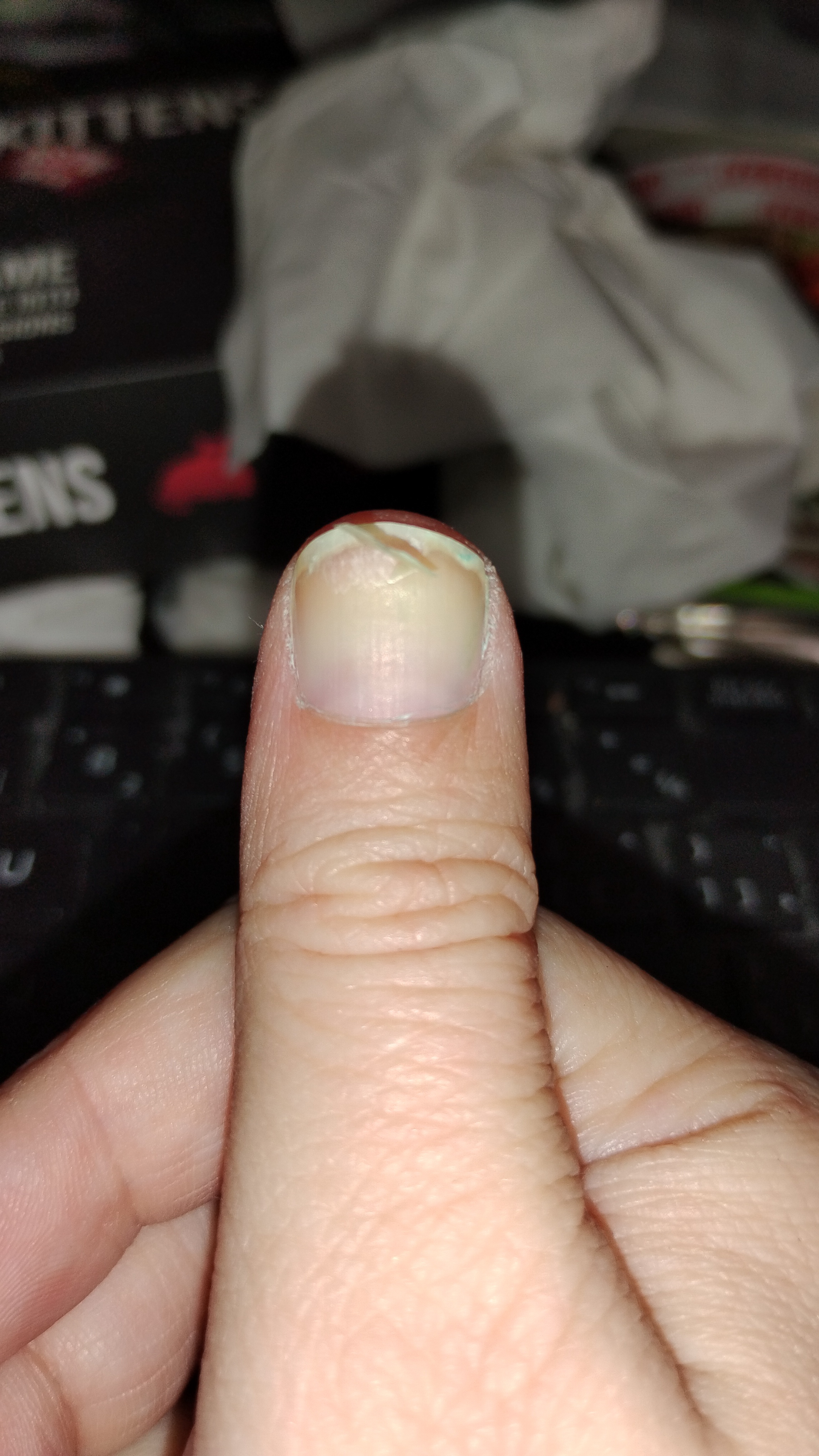 I Completely Ruined My Nails!