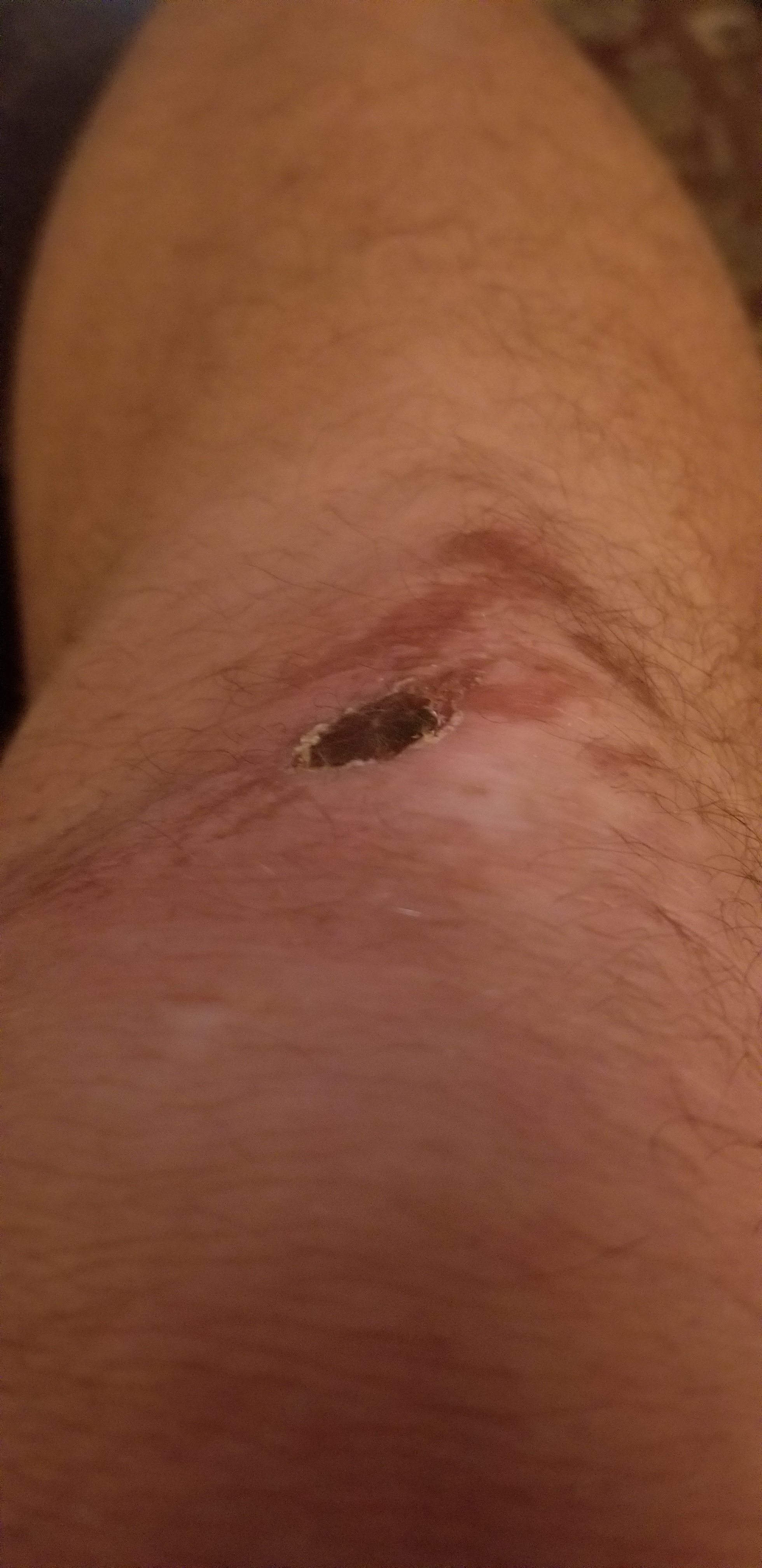 Should I Take the Leap?