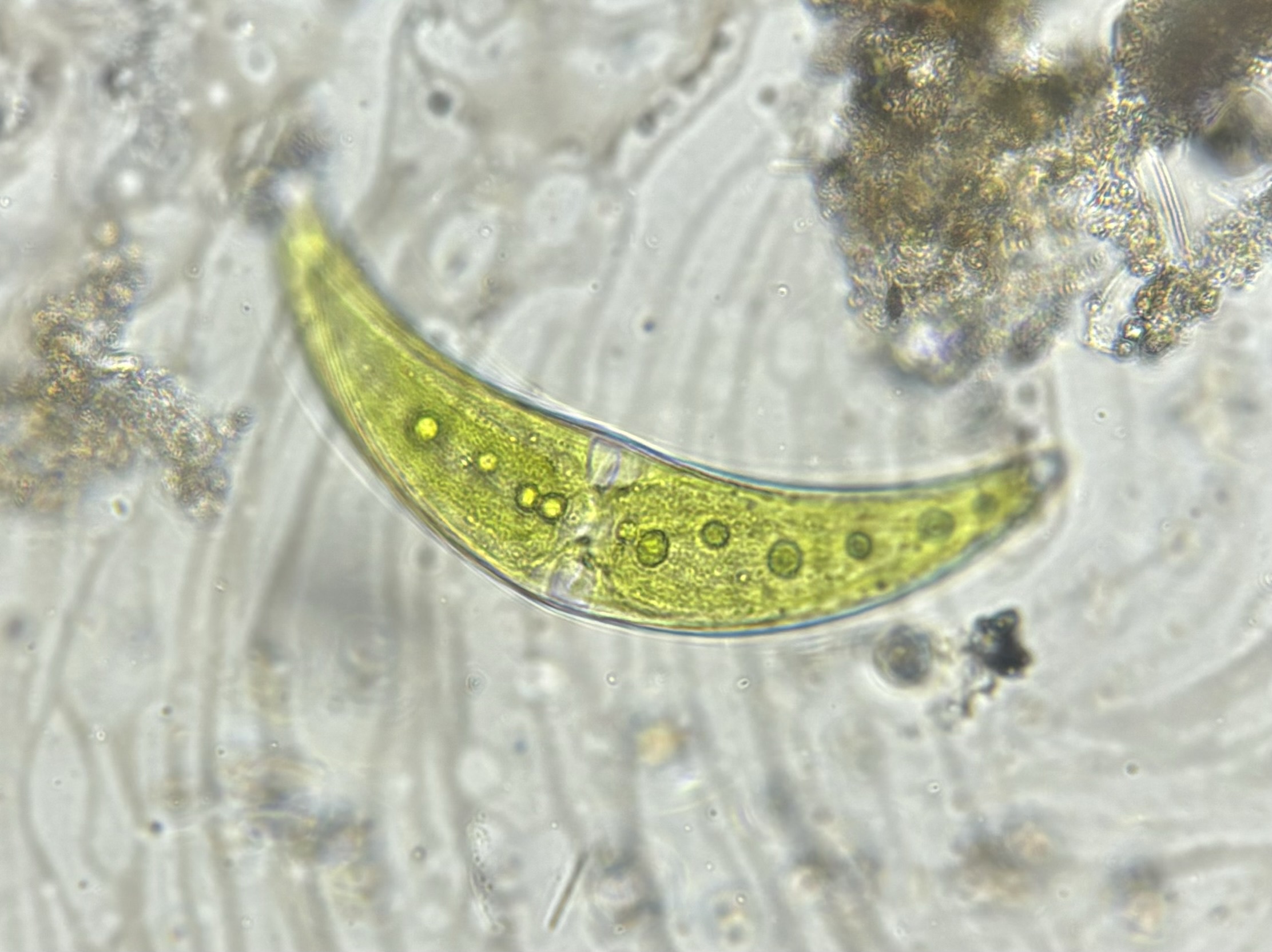 The wonders of algae: nature's little miracle.