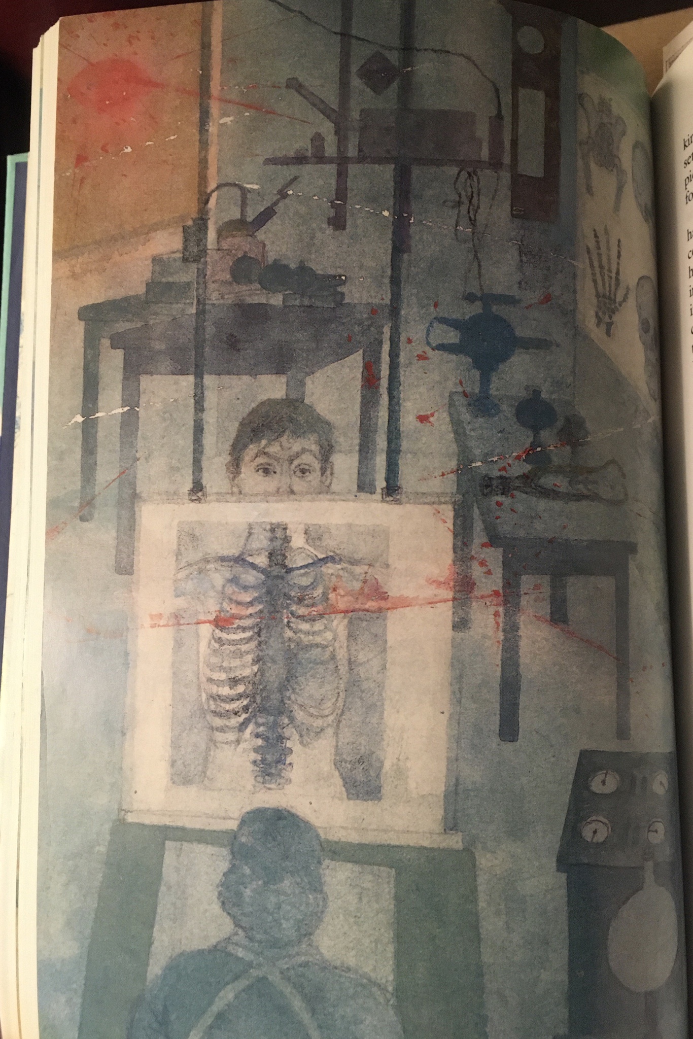 Folio Edition of The Magic Mountain: A Glimpse into Joachim's X-Ray