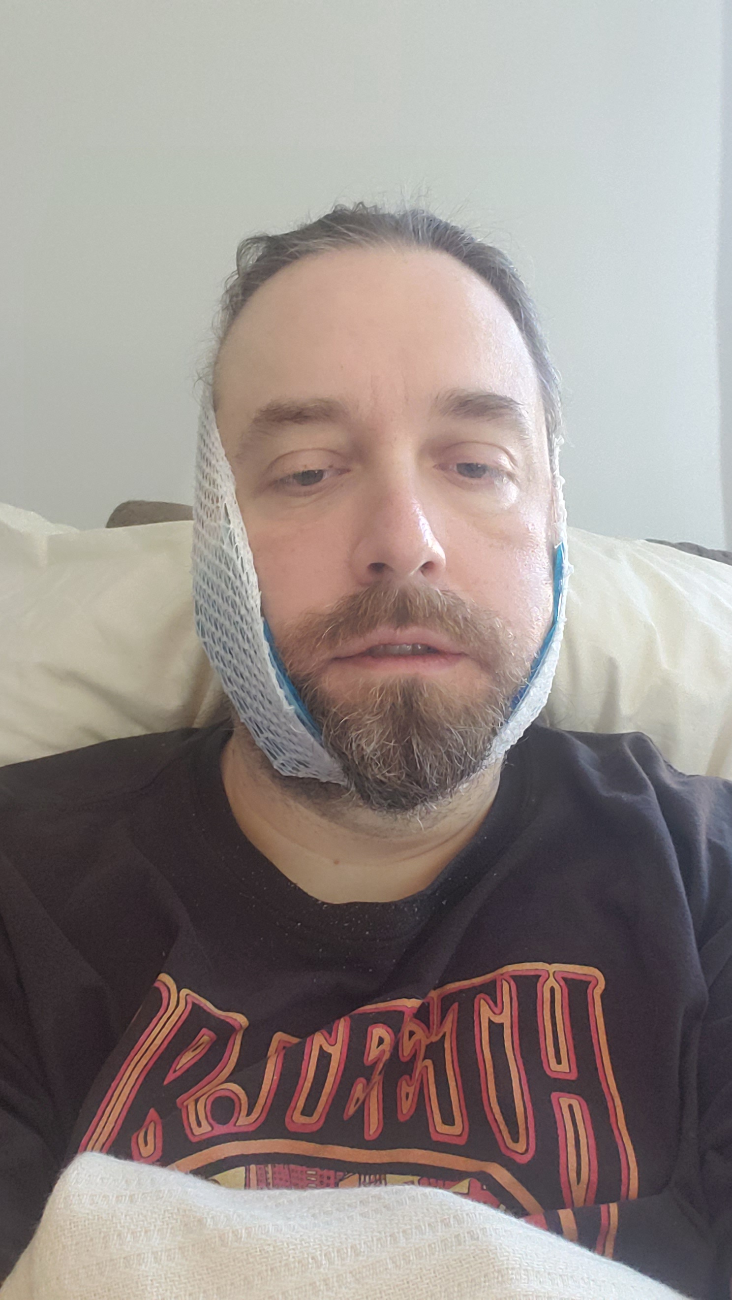 Merry Christmas! Here’s my only recent selfie after getting 5 teeth pulled!