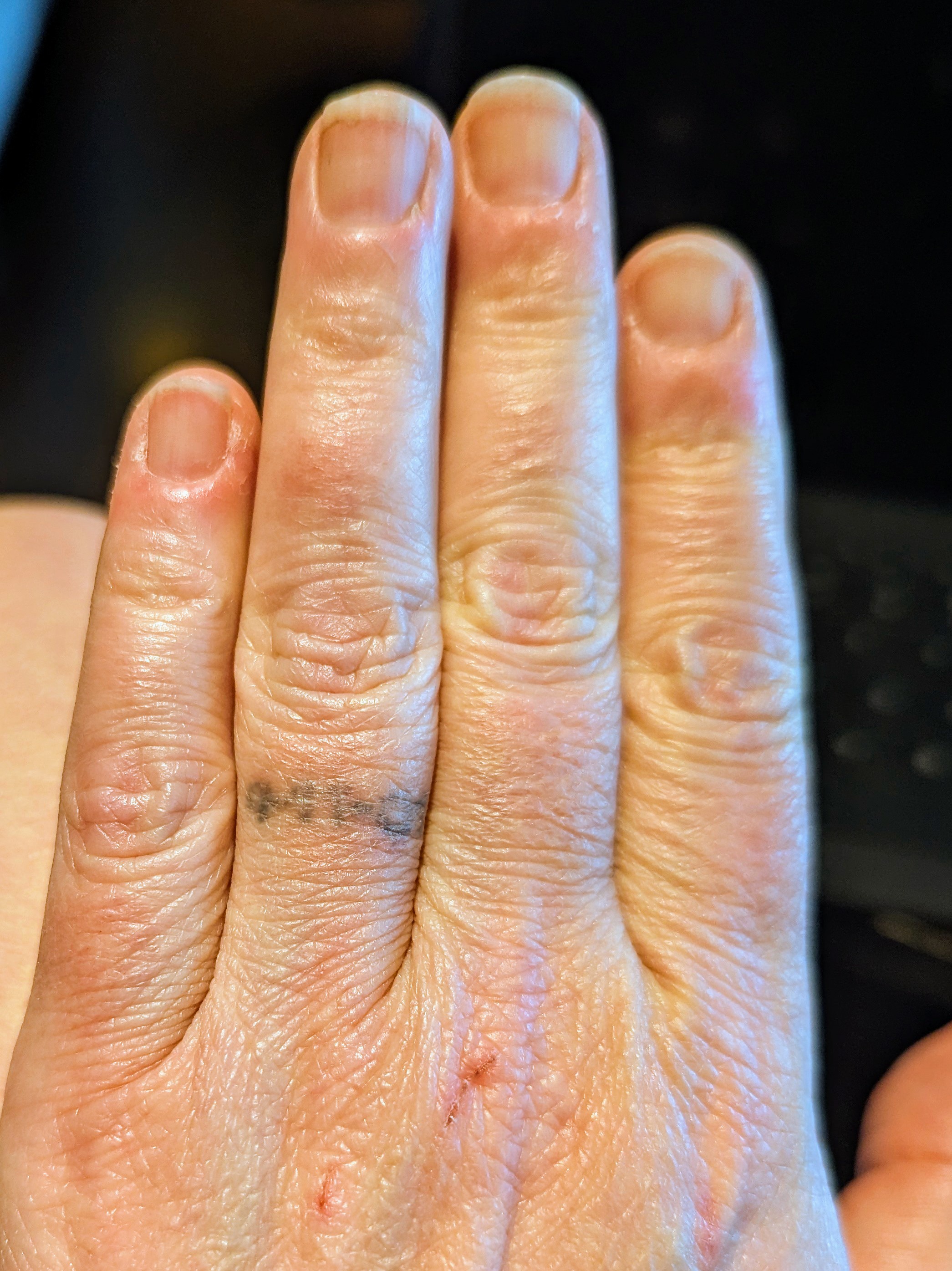 Transforming a Hand Tattoo: The Cover-Up Journey