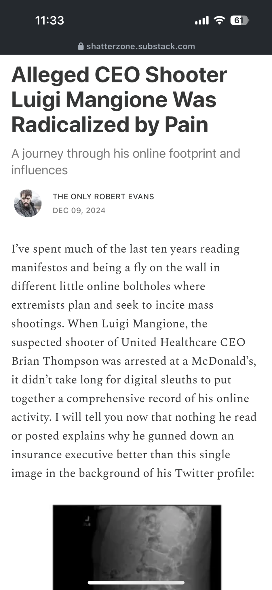 The Alleged CEO Shooter: A Story of Radicalization Through Pain