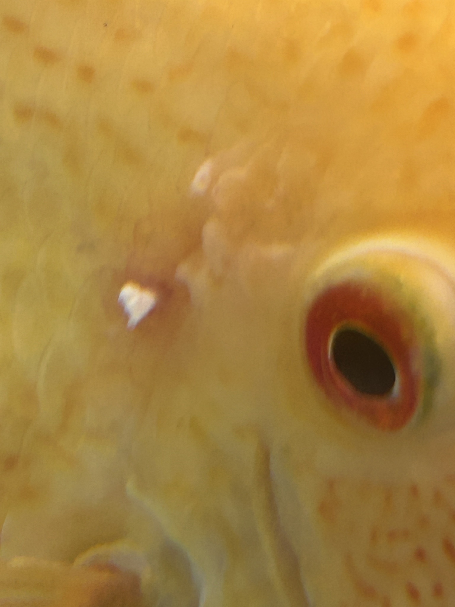 The Gold Severum Infection: A Trendy Dilemma