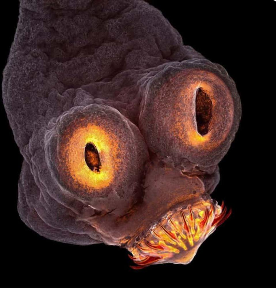 Meet your new friend: the tapeworm!