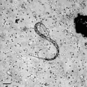 White Blood Cells Going to Battle Against a Parasite