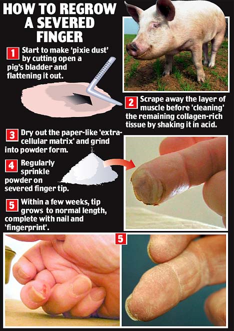 Regrowing a Finger: The Incredible Role of a Piggy