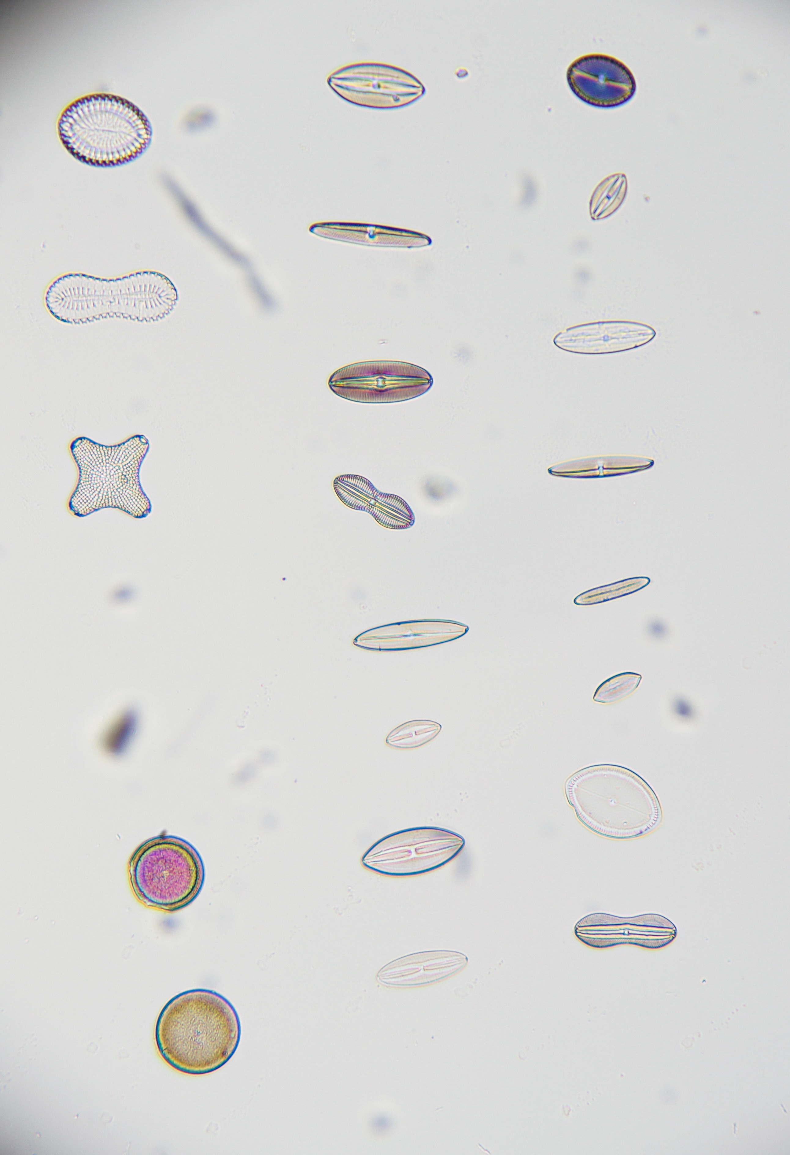Not the Best Photos, But Check Out These Awesome Diatoms!