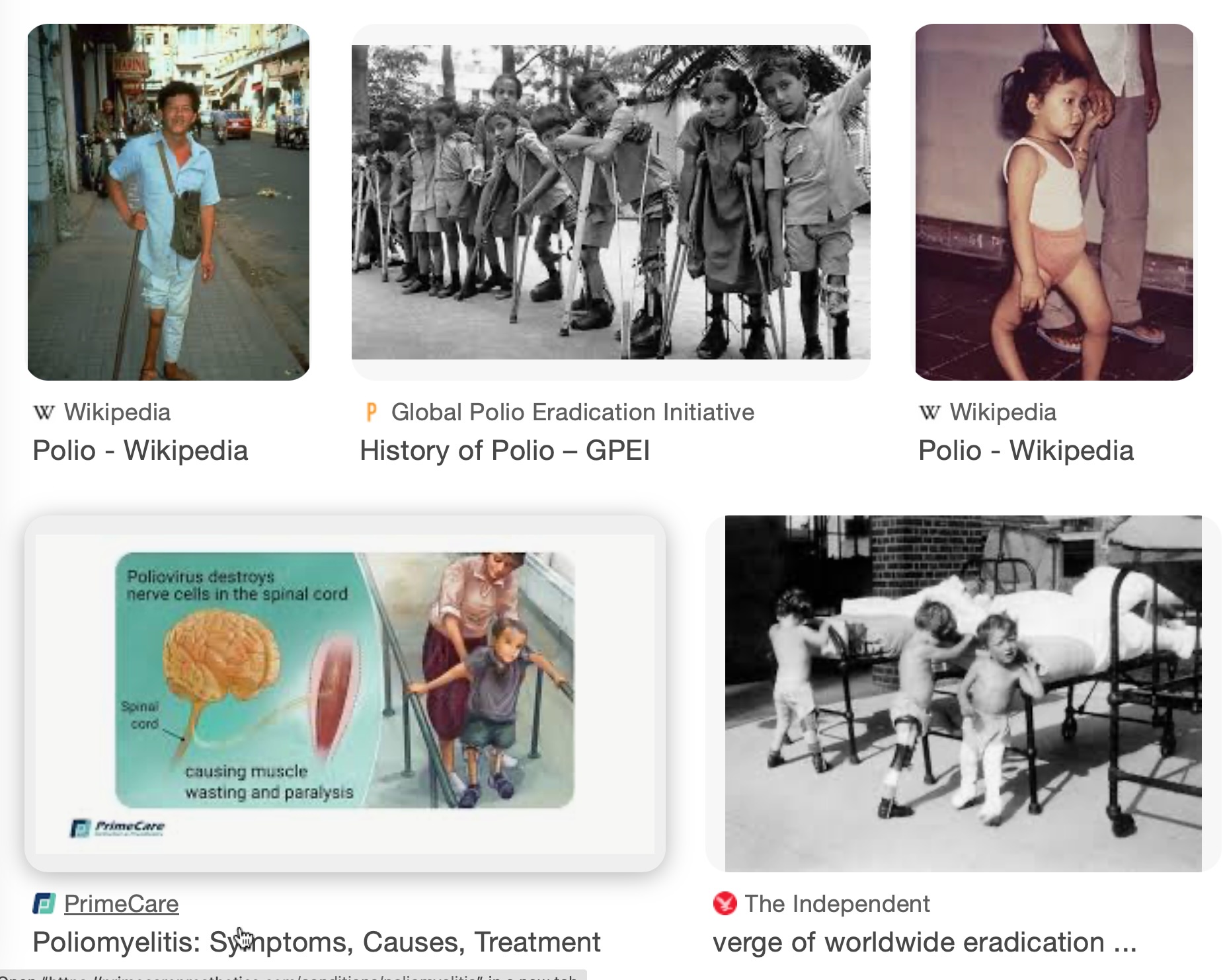Let's Bring Back Polio! (Just Kidding)