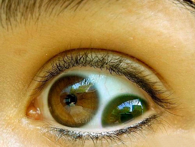 Exploring SCP-1209: Many Eyes Watching Everywhere