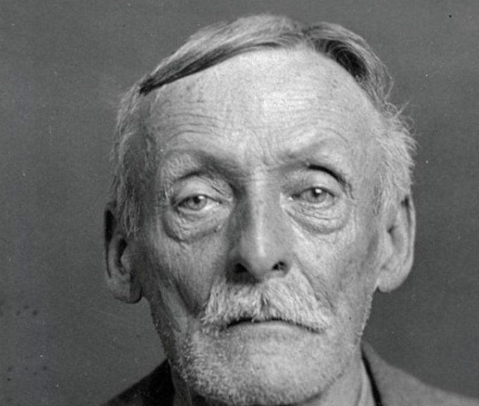 An X-ray revealing the shocking secrets of serial killer Albert Fish's pelvis.