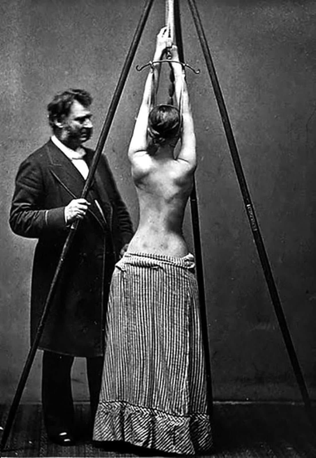 Dr. Lewis Sayre: Pioneering Scoliosis Treatment in the 1870s