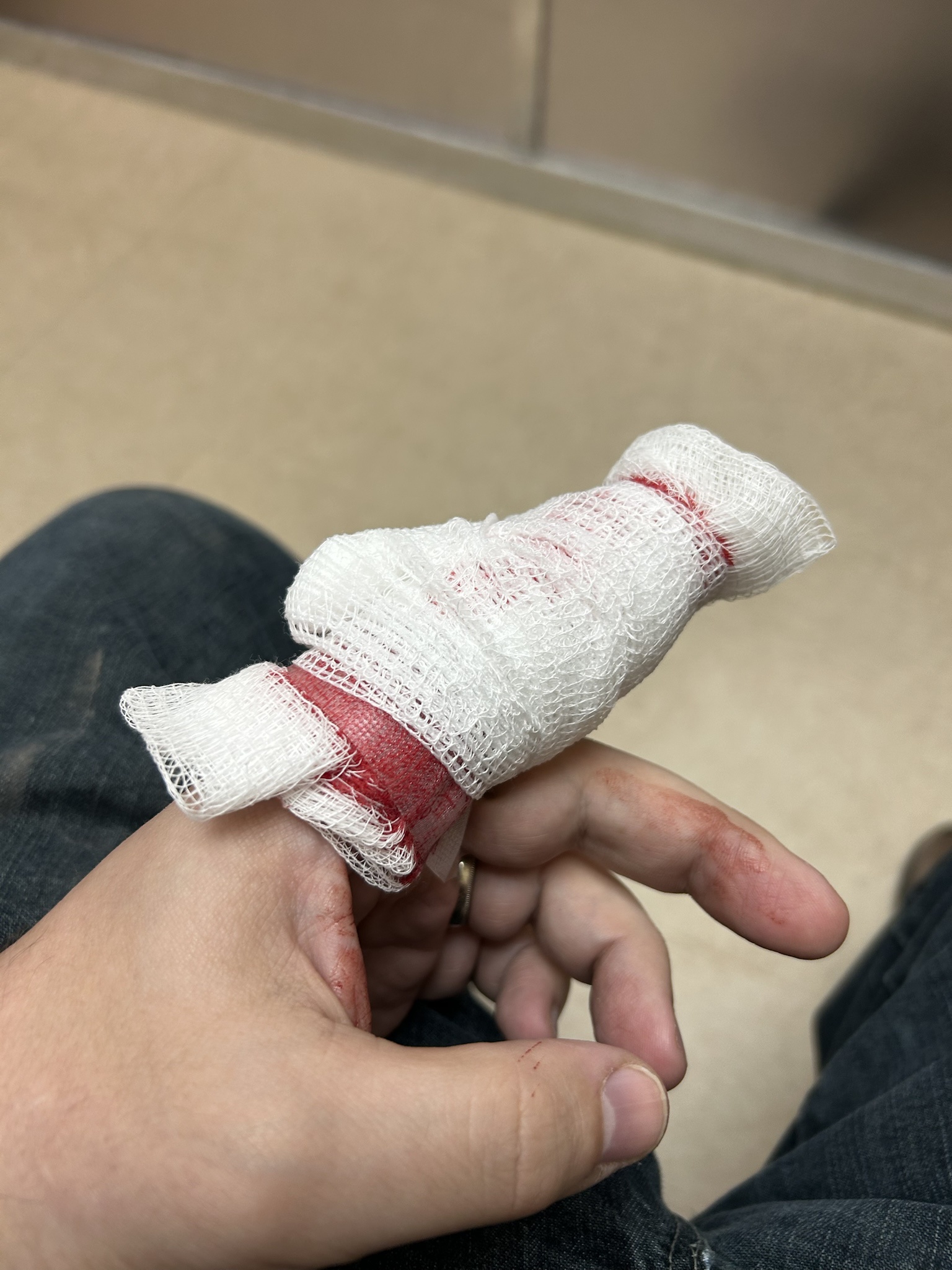 Stitches definitely weren't on my Christmas wish list!