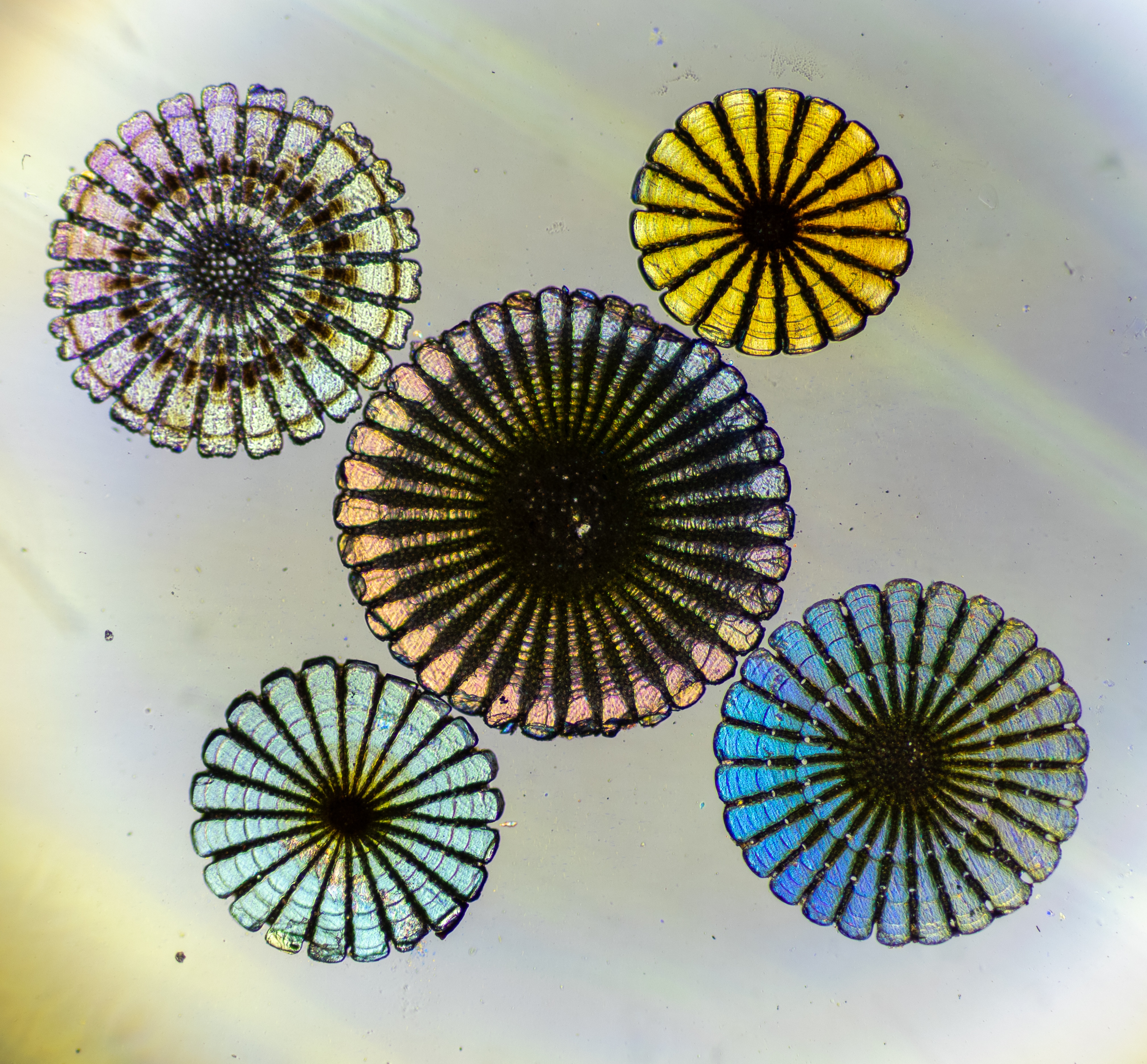 Incredible Close-Up: Sea Urchin Spines Magnified 40 Times