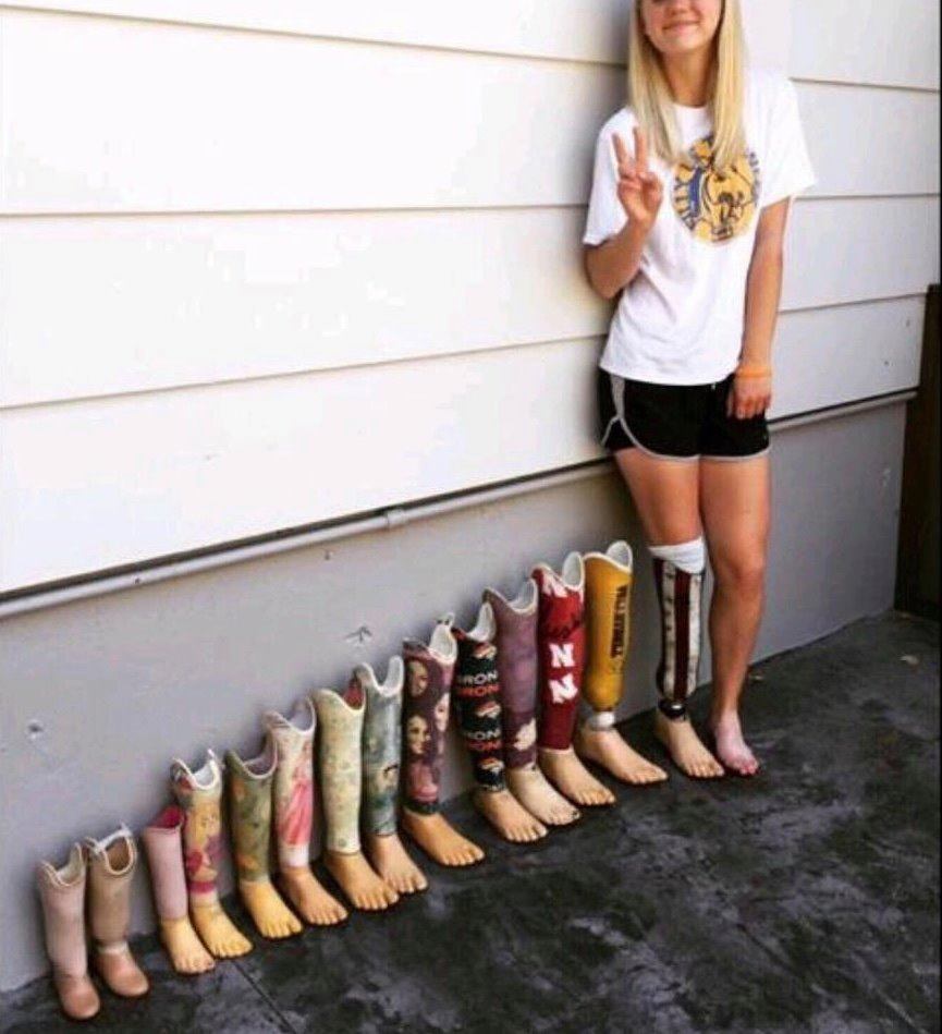The Evolution of a Prosthetic Leg