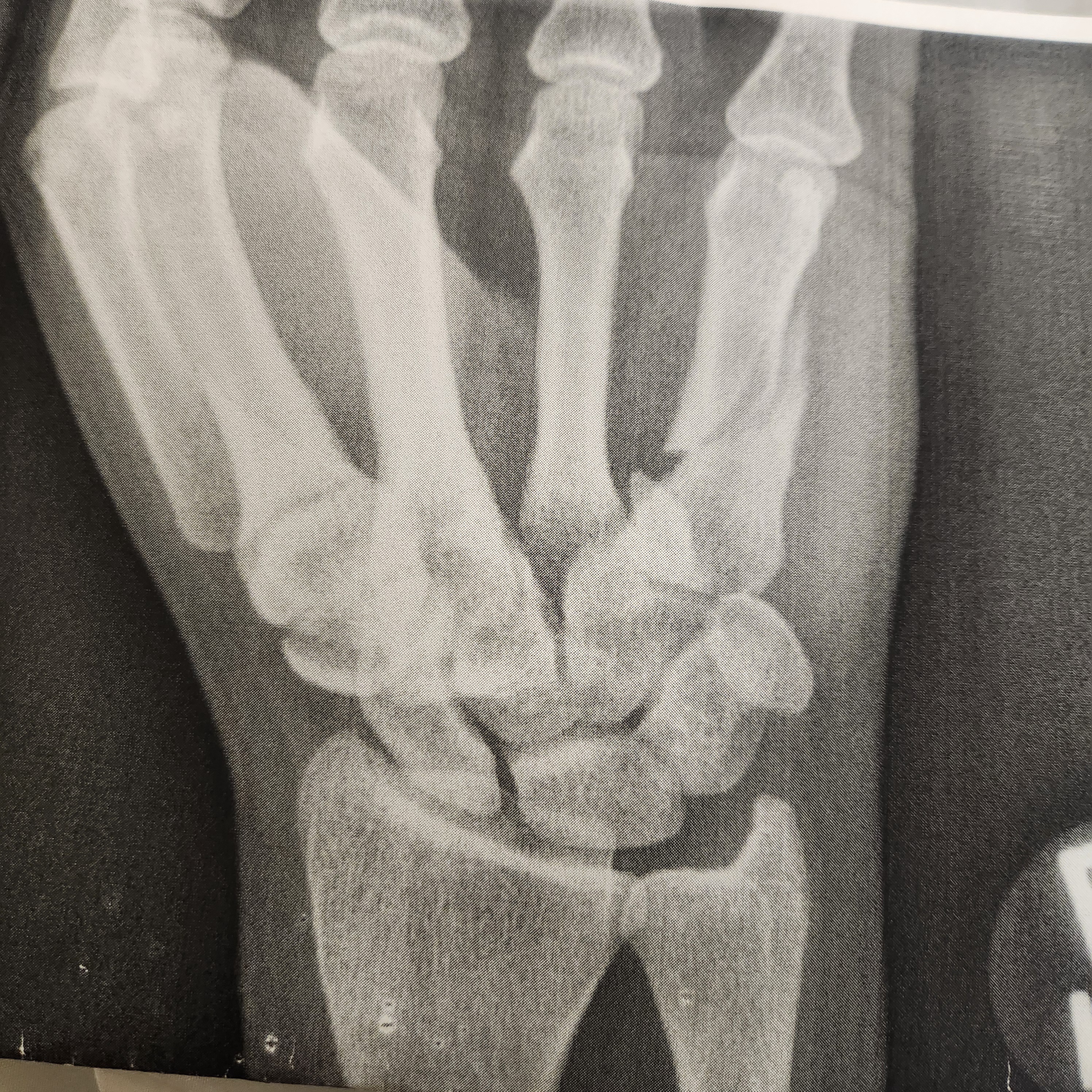 Awkward Timing: Facing Surgery Right During the Holiday Season!
