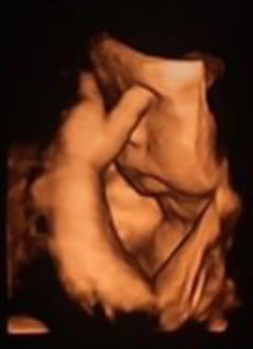 This Unborn Baby Seems to Prefer Staying Cozy Inside