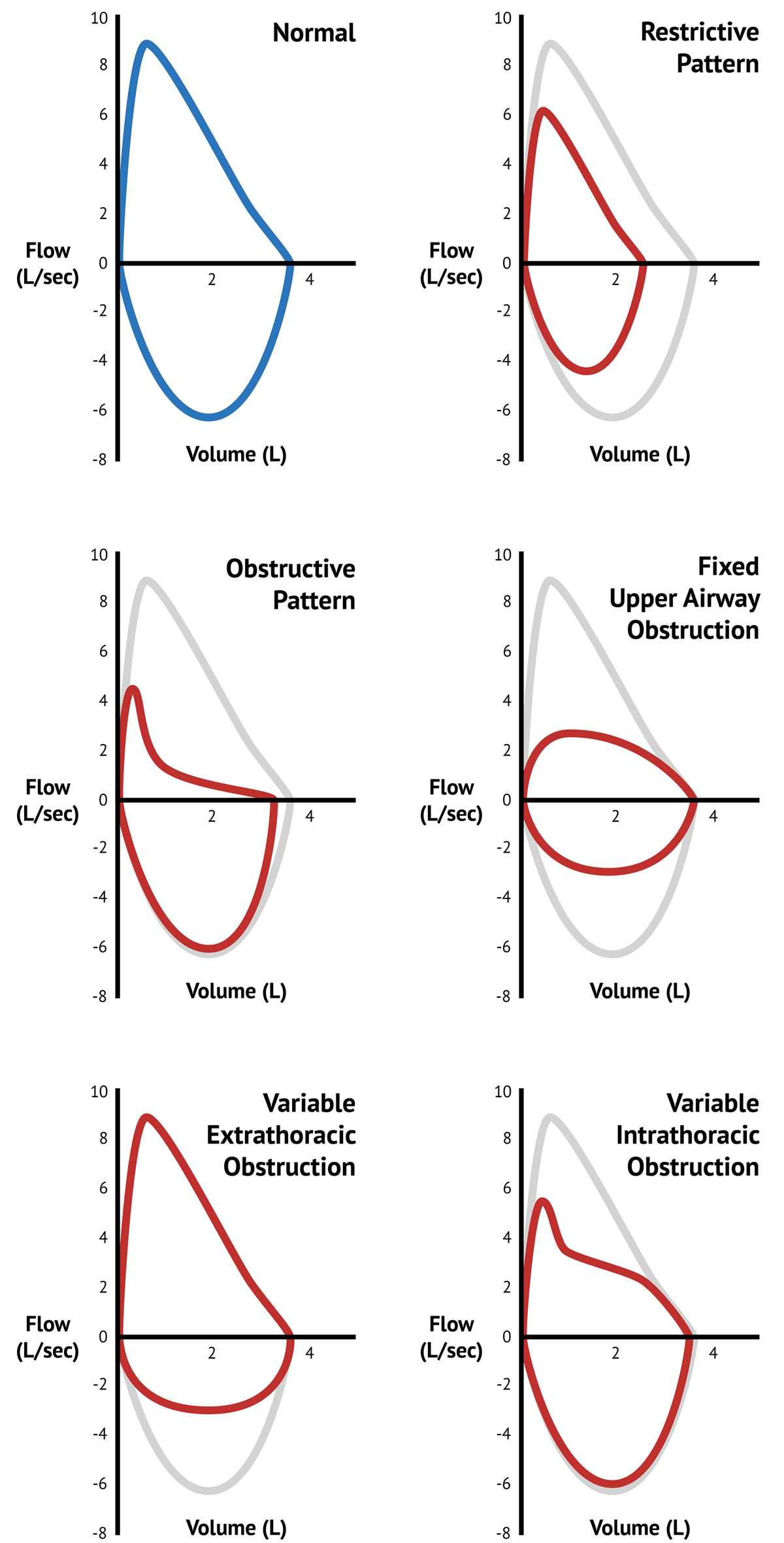 Understanding the Flow Volume Loop